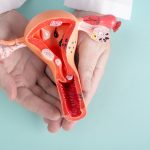 Pemeriksaan Kanker Serviks: Perbedaan Pap Smear, HPV DNA, dan IVA 