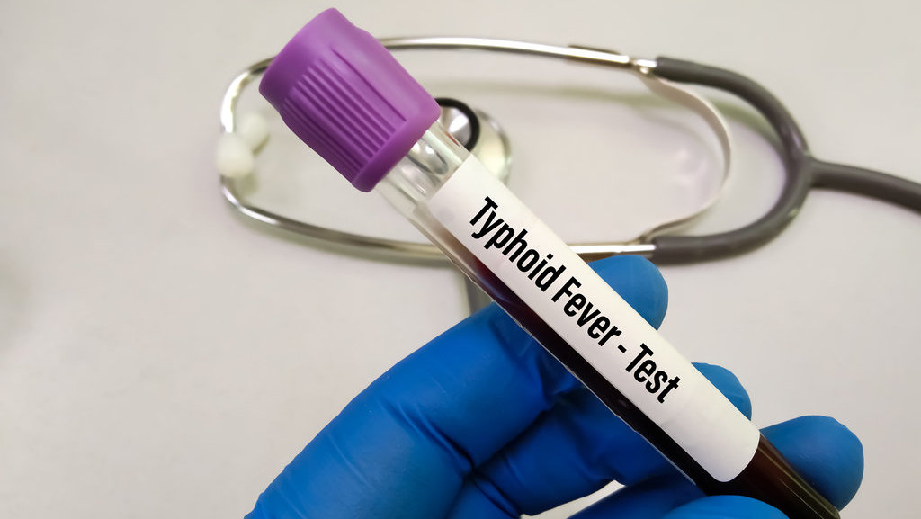 12-pantangan-makanan-penyebab-tipes-yang-harus-dihindari