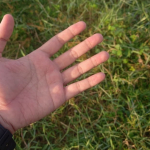 7 Penyebab Telapak Tangan Berkeringat dan Dampaknya