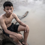 Gizi Buruk pada Anak: Penyebab, Dampak, dan Solusi