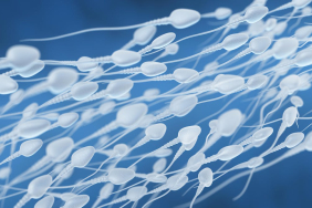 benarkah-sering-ejakulasi-bisa-kurangi-risiko-kanker-prostat?-jawabannya-tidak-sesederhana-itu